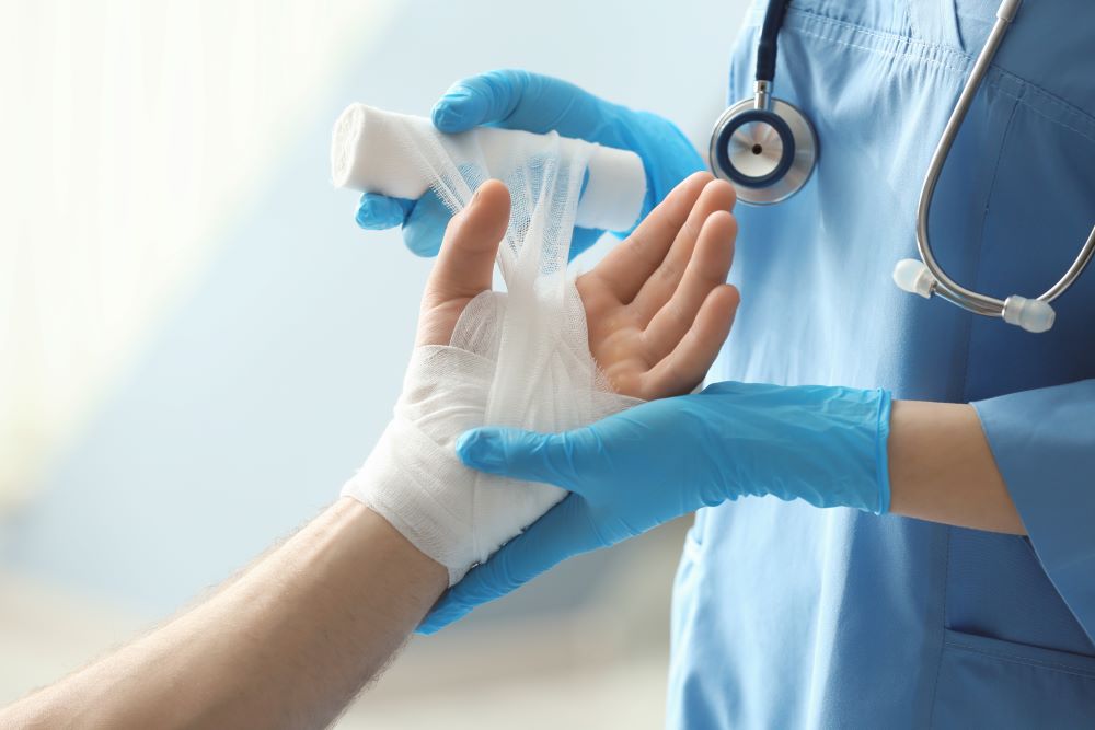 burn injury on hand